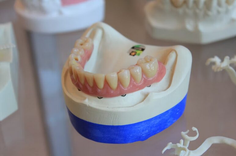 stained dentures